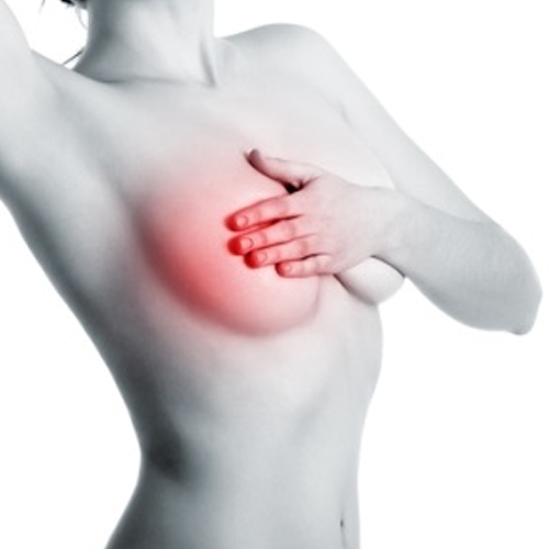 breast3