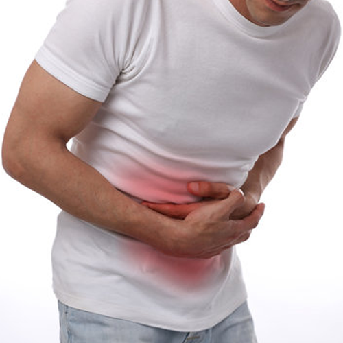 Colon cancer 
