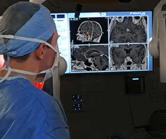 advanced-endoscopic-skull